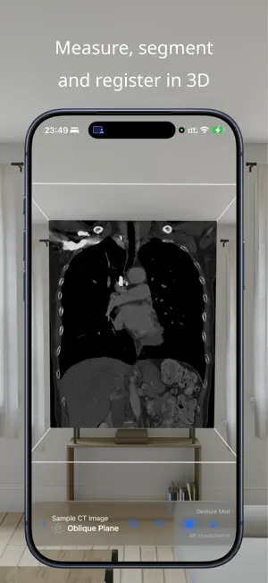 VoxelVision AR Medical Imaging screenshot 1