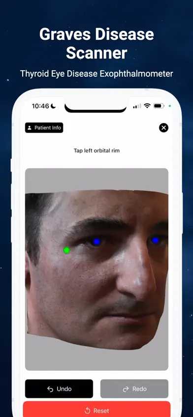 Graves and Thyroid Eye Disease screenshot 1