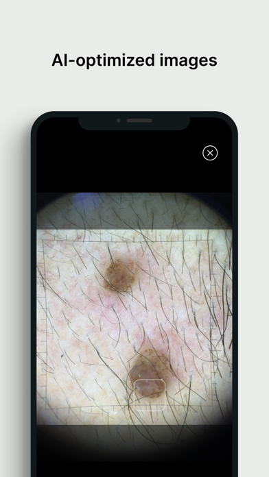 Dermloop Capture Screenshot