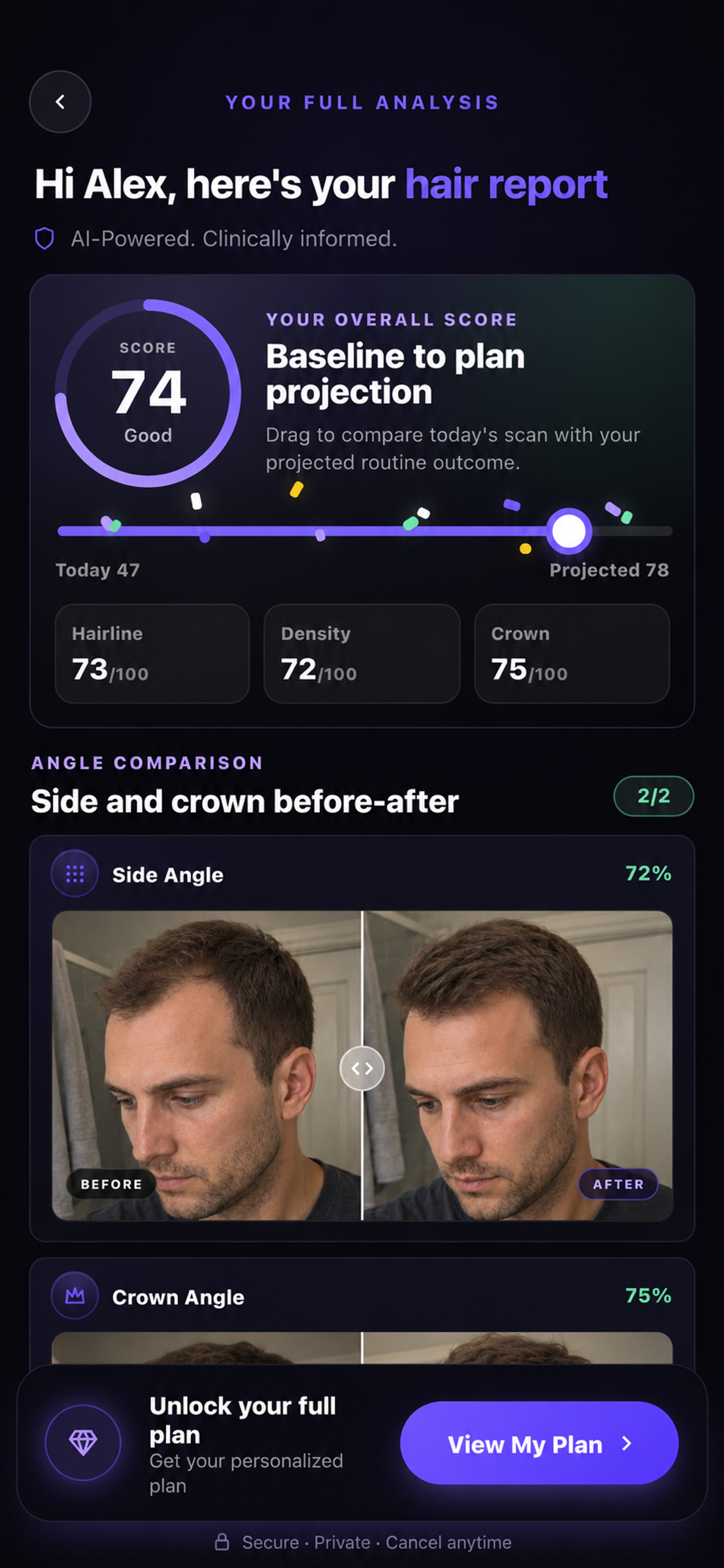 Hairloss Scan AI - HairCheck