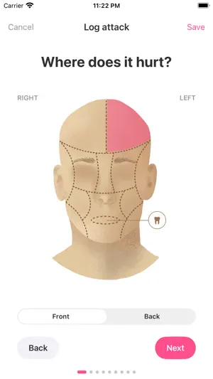 Migraine Tracker & Diary: MiG screenshot 2