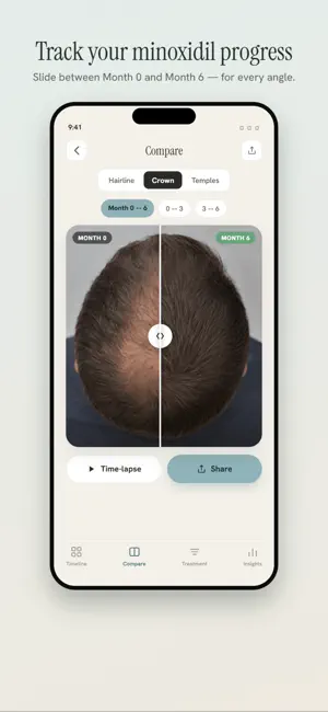 Hairlapse: Hair Growth Tracker screenshot 1