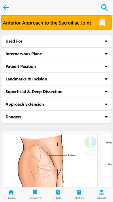 Orthopedic Surgery Approaches Screenshot