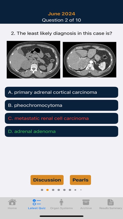 CTisus iQuiz 25 screenshot-3