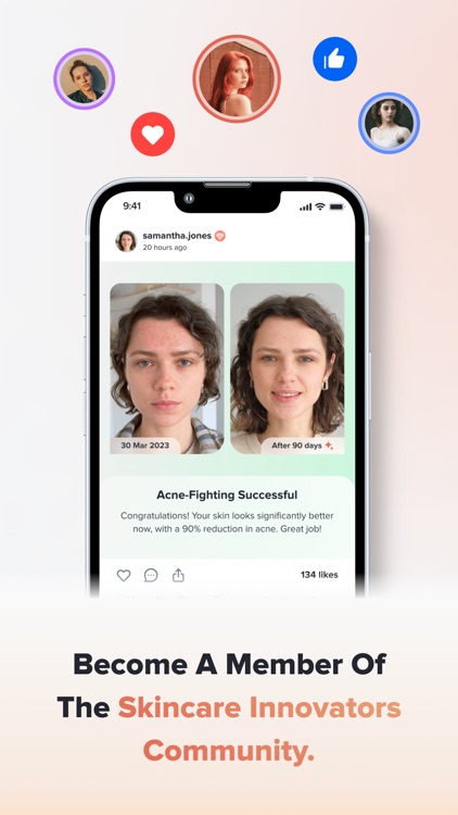 Acie: Personalized Skin Coach screenshot-4