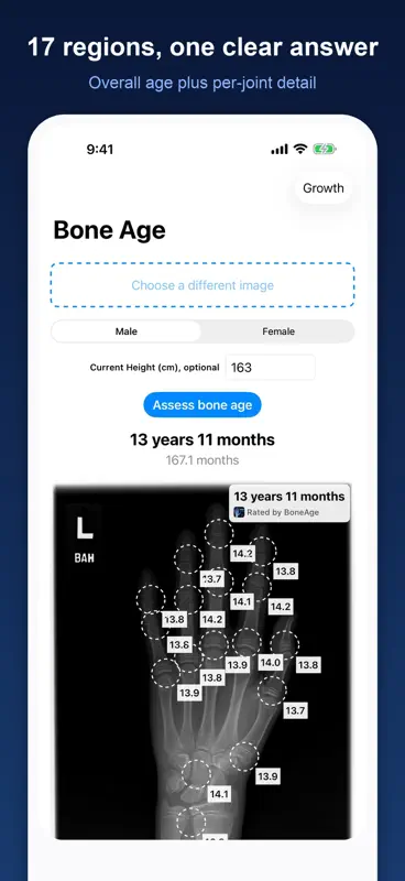 Bone Age: X-Ray Image Rater screenshot 2 of 5