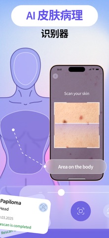 AI Skin Scanner - SkinAI screenshot