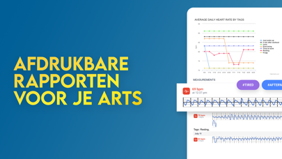Instant Hartslagmeter iPhone app afbeelding 4