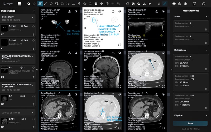 Dicom Browser Screenshot