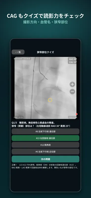 血液ガスCAG道場 screenshot 9 of 9
