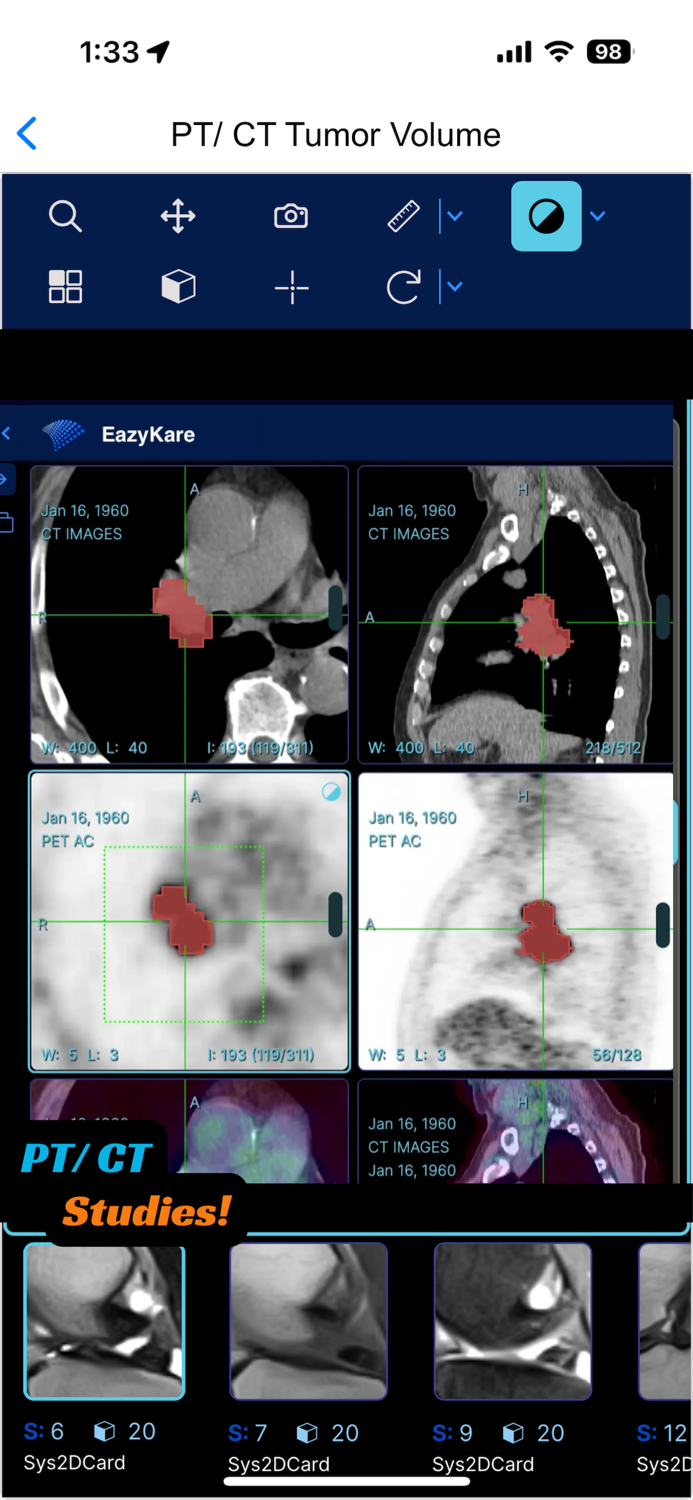 EazyGo  Easy PACS  DICOM