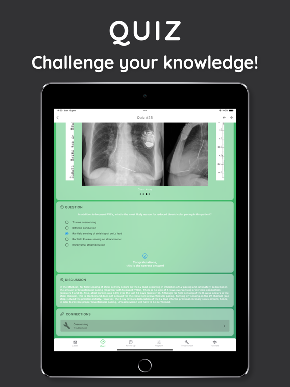 iPacemaker AI Follow-up iPad screenshot 4 - Medical app