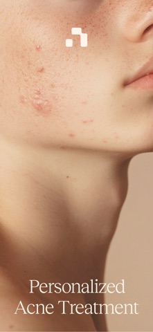 Nolla Derm app screenshot