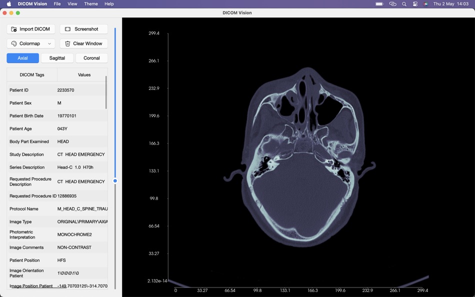 DICOM Vision - 1.2.1 - (macOS)