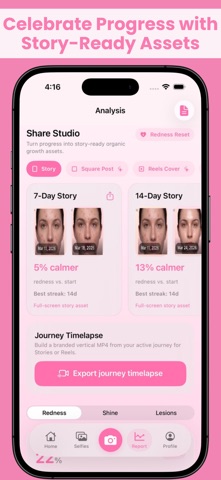 SelfieLog: Acne Tracker Screenshot 6 of 7
