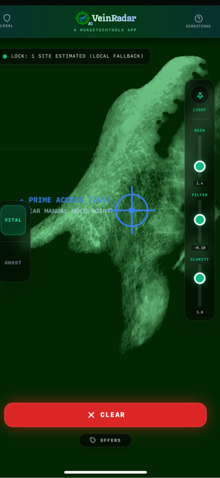 VeinRadar Screenshot 3 of 6