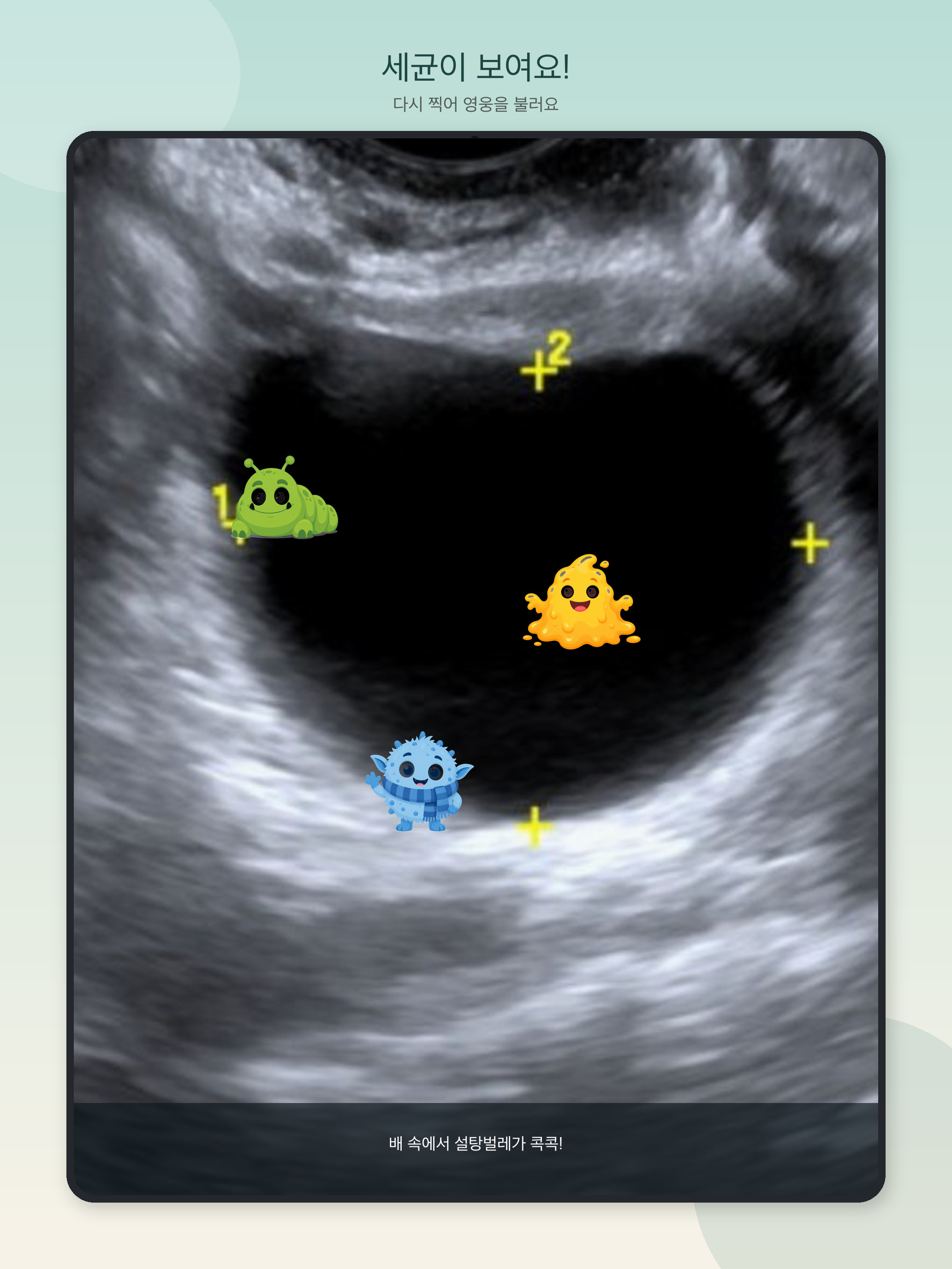 Peekabody screenshot 11