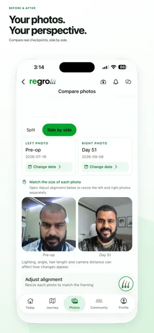 Regrow: Hair Transplant Care screenshot 2