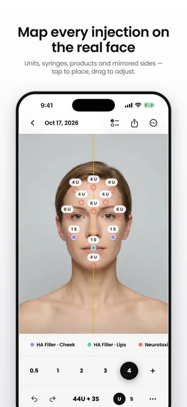 Injector Planner: Mapa Botox screenshot 1 of 8