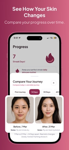 Roona: Skincare Tracker Screenshot 1 of 7