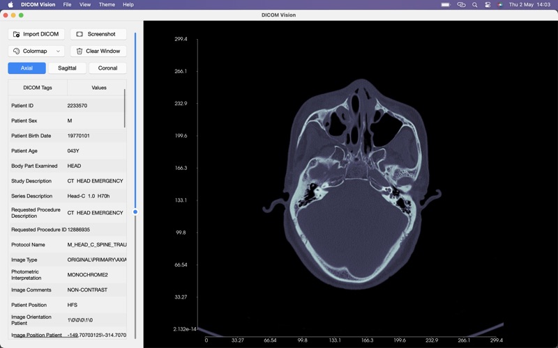 DICOM Vision Screenshot