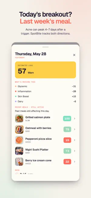 SpotBite: Acne Food Scanner screenshot 4
