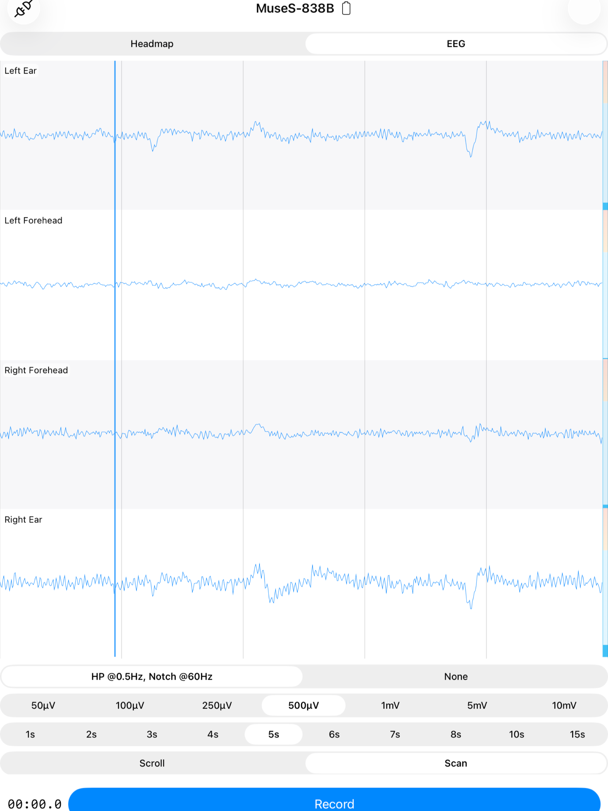 EEG Recorder