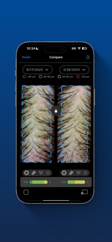 VEOS® HairMetrix® iPhone screenshot