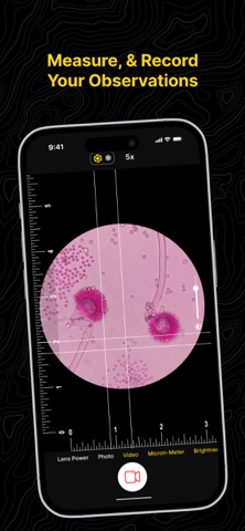 MicroScope Adapter Camera app Screenshot 4 of 4