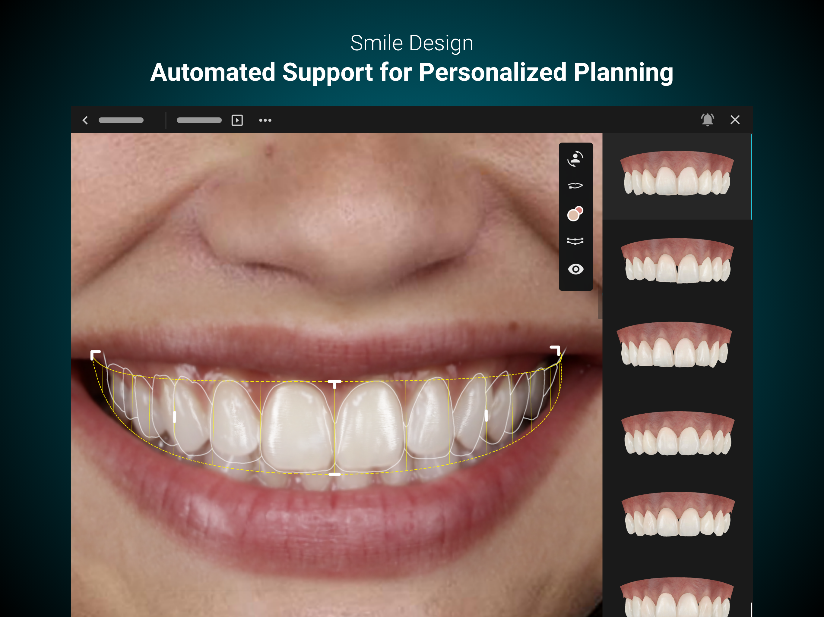Smilecloud