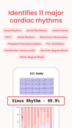 ECG Buddy screenshot 3