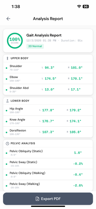 Gait Analysis Vision Screenshot 4 of 5