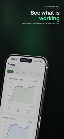 Trichometrics: Hair Loss AI screenshot