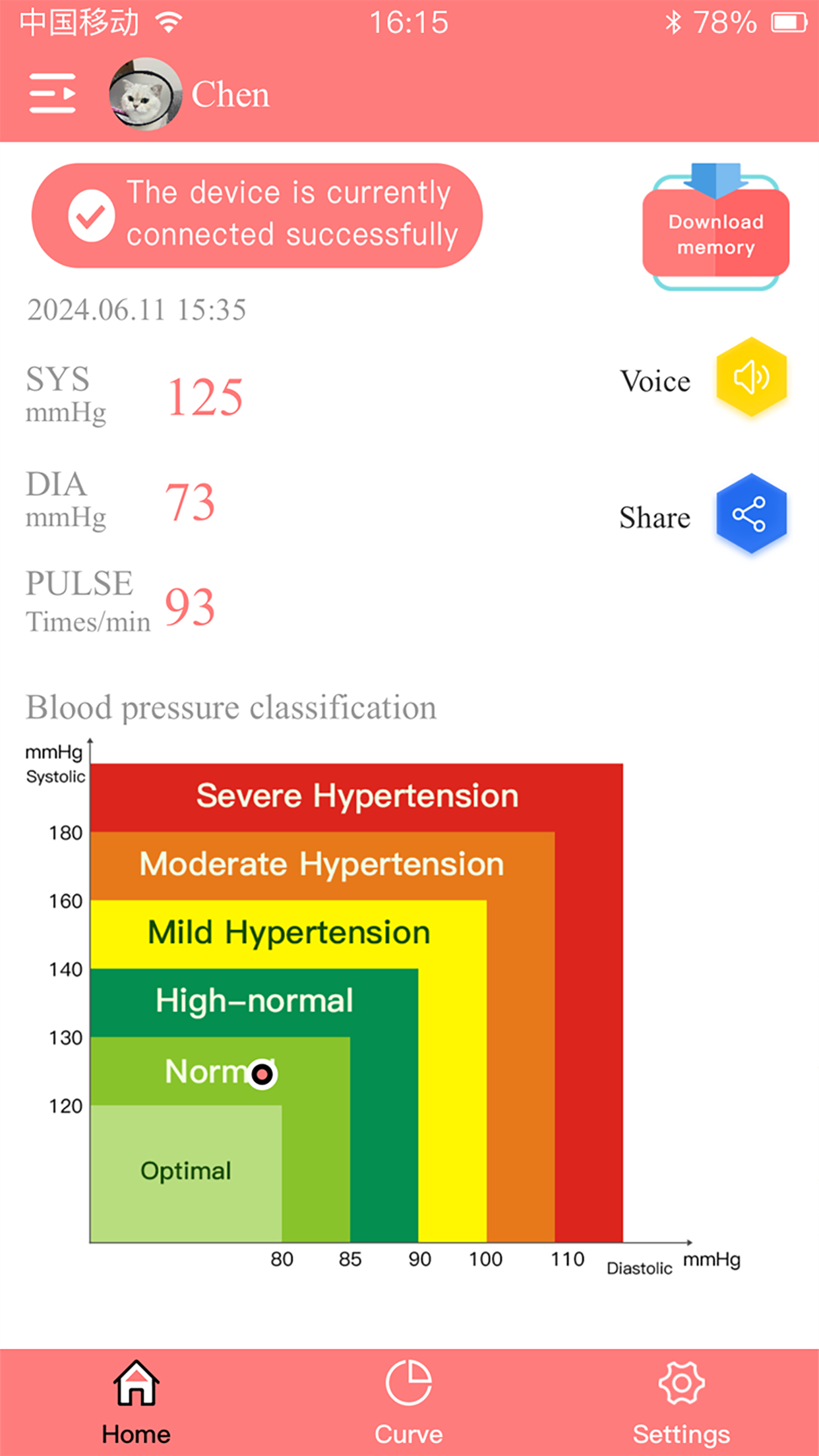 BP+ECG