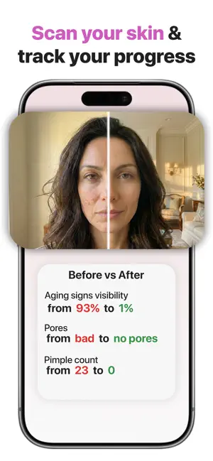 MySkincare AI Skincare Scanner screenshot 4