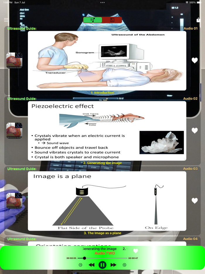 Ultrasound Guide Case Studies
