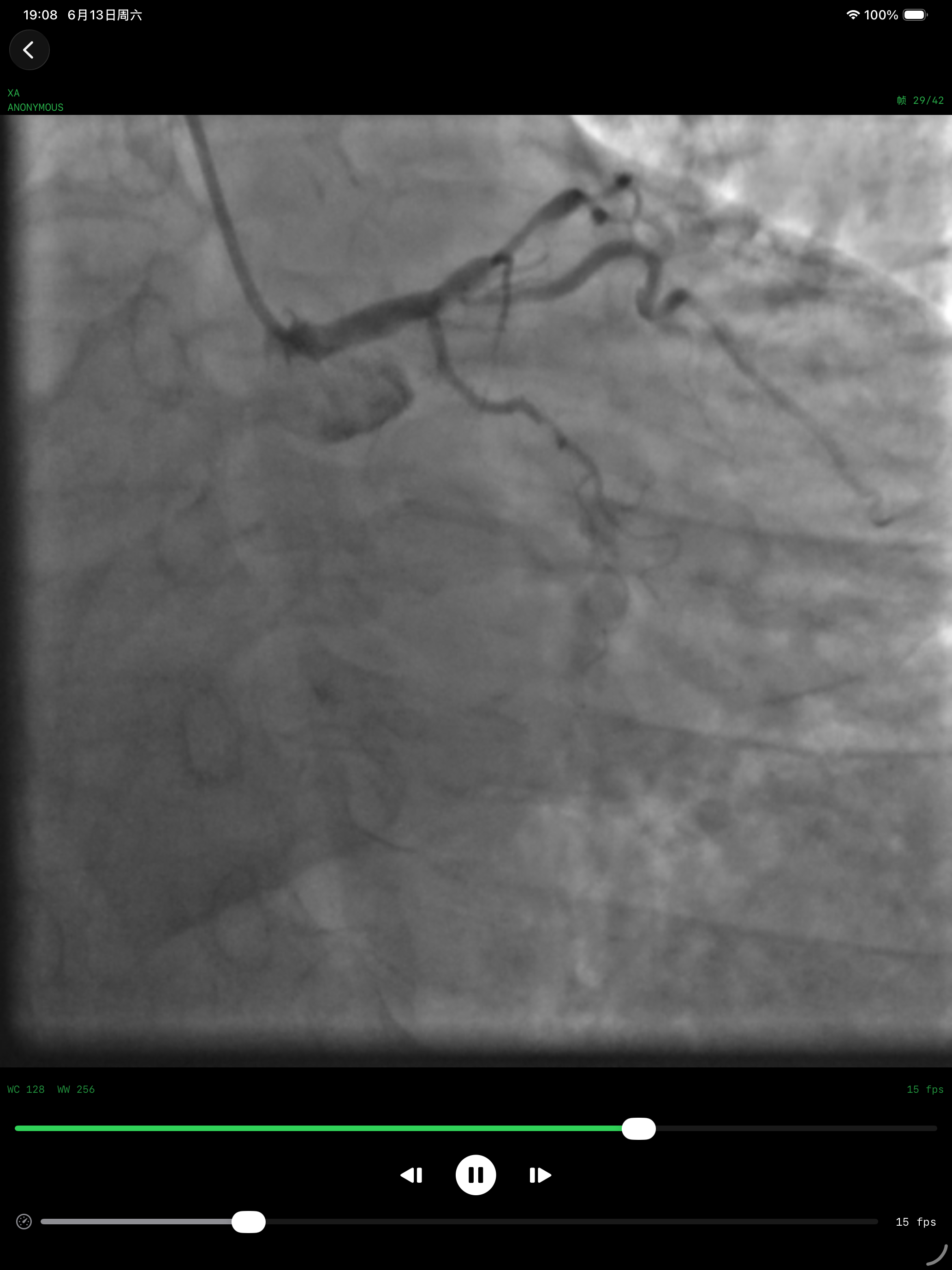 DICOM Player screenshot 6