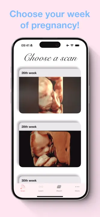 ScanBaby learn baby ultrasoundのスクリーンショット（2/8）