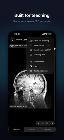 Voxelis: DICOM Viewer Screenshot 6 of 9