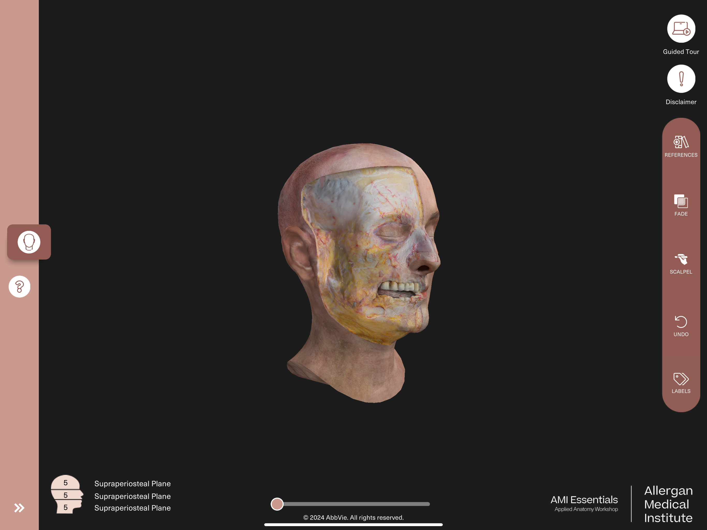 AMI Essentials:3D Anatomy BNL screenshot 18