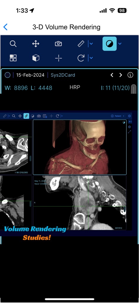 EazyGo | Easy PACS & DICOM - App de Medicina | MWM