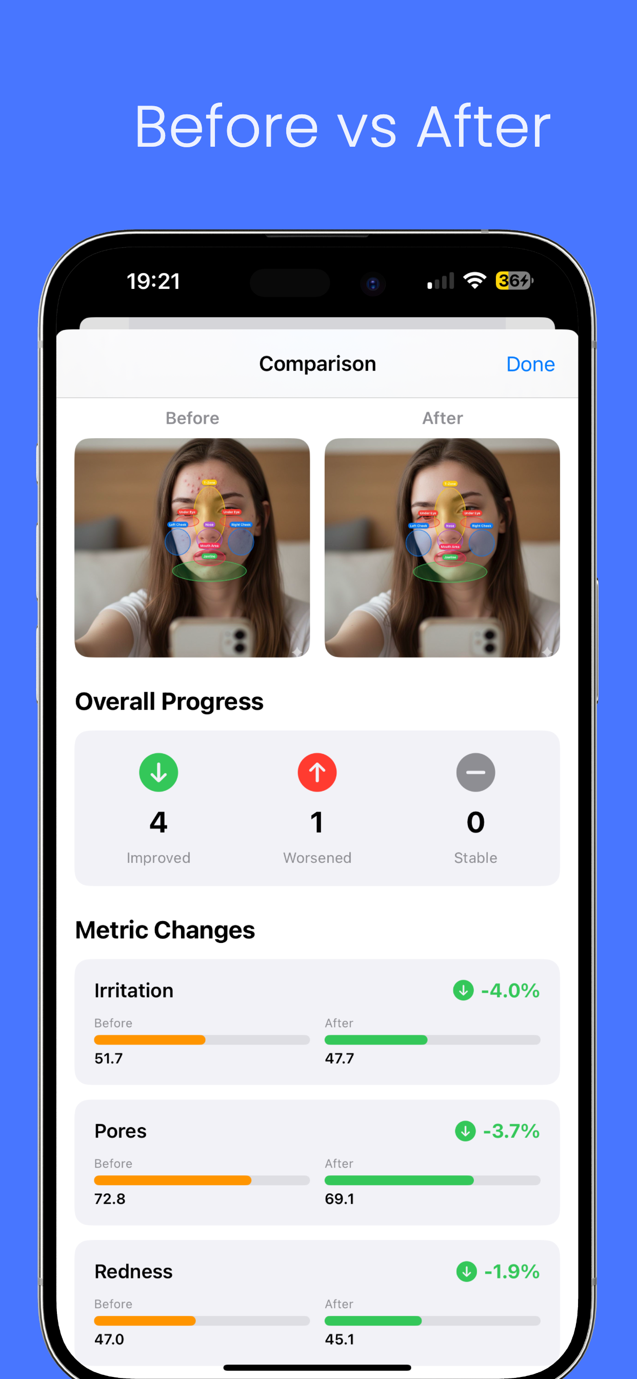 Skinalyzetracker