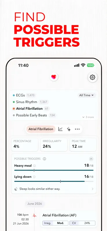 ECG+ | Interpretação de ECG screenshot 4 of 10