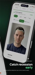 Trichometrics: Hair Loss AI screenshot