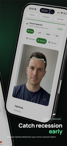 Trichometrics: Hair Loss AI screenshot