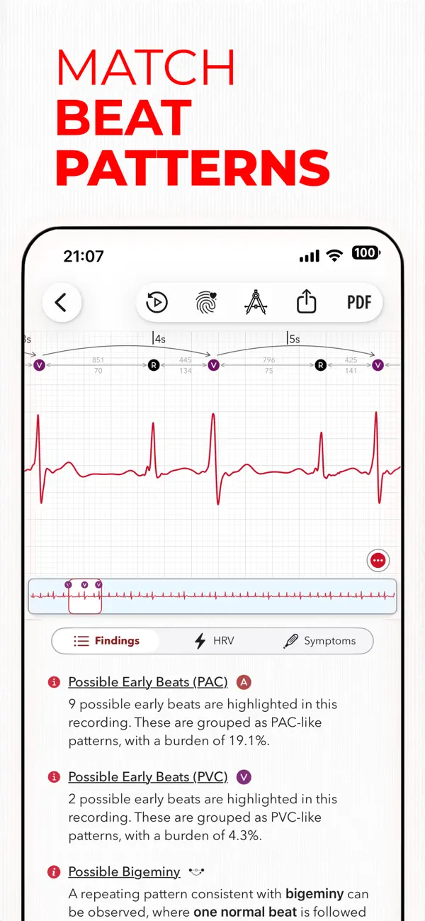 Screenshot #3 pour ECG+ | Analyse ton ECG Watch