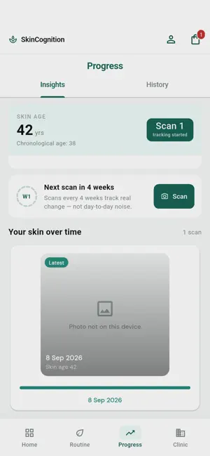 SkinCognition screenshot 4