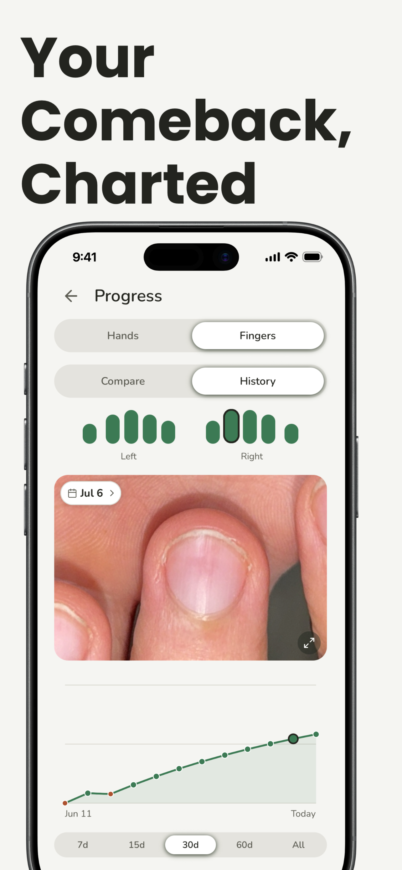 Stop Nail Biting: Nonyxa screenshot 5