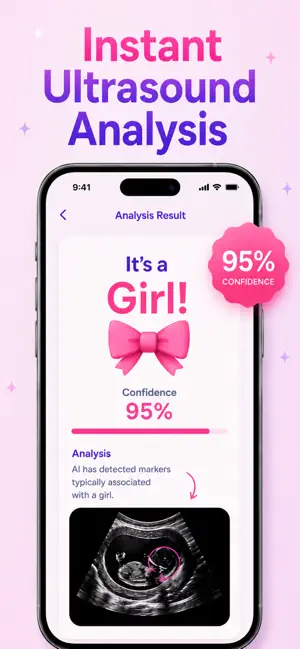 Baby Gender Scanner: Nub Test screenshot 2