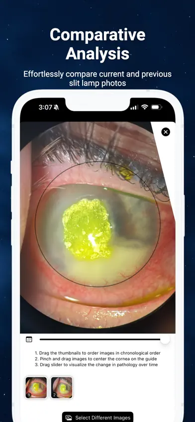 Slit Lamp Camera screenshot 2
